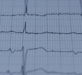 Exame Florianópolis ECG