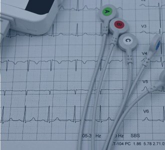 Exame Florianópolis Holter